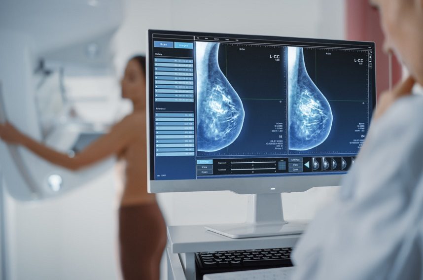 mamografia-1b.jpg