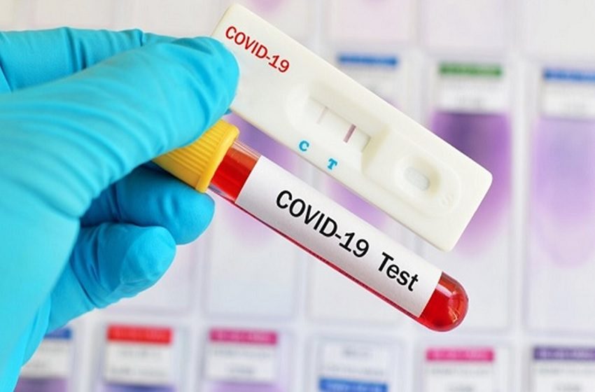 teste-covid-coronavirus.jpg